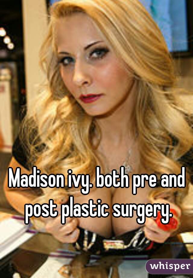 Madison Ivy Before Implants